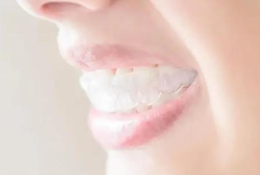 戴牙套吃完東西光漱口行嗎?孩子戴牙套有什么危害