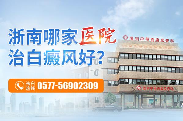 溫州中研白癜風專科怎么樣?白癜風患者飲食注重哪些呢