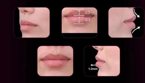 海峽整形-唇部抗衰新品首發,喬雅登質顏 開啟廈門集美圈“唇動”時刻