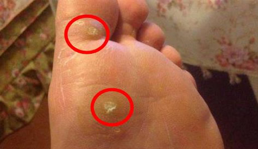 ����Д��ǲ����u�ۣ��u����ʲô�Lʲô���ӈDƬ