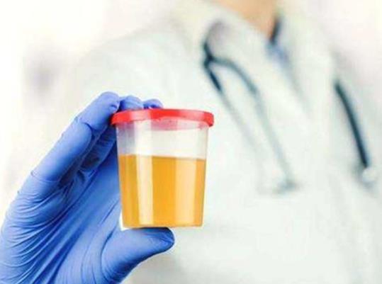 尿酸一周從500降到200正常嗎?尿酸高過一次就是終身疾病嗎