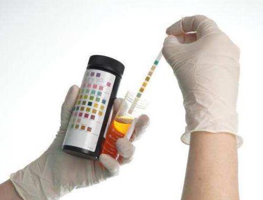 大量喝水幾天能把尿酸降低?不喝酒飲食清淡為什么尿酸還高