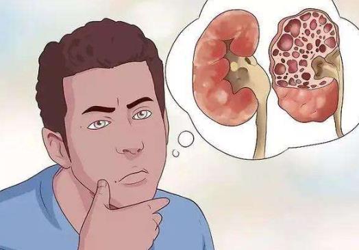 尿酸偏高會影響入編體檢嗎?尿酸高會引起痛風嗎