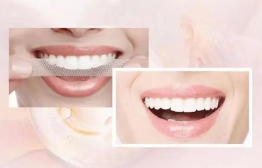 美白牙貼飯后多久用?美白牙貼怎么用最有效