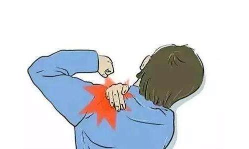 肩周炎的5種有效鍛煉方法