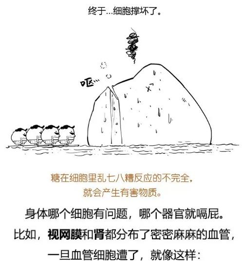 漫畫科普-糖尿病治療新模式