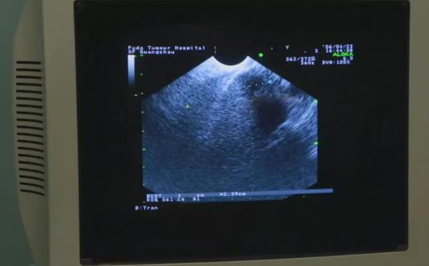 廣州復(fù)大腫瘤醫(yī)院技術(shù)評價 以名求贏口碑相傳