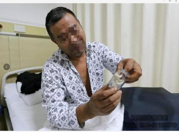 四川結(jié)石病醫(yī)院服務(wù)怎么樣 專(zhuān)業(yè)贏在優(yōu)質(zhì)服務(wù)