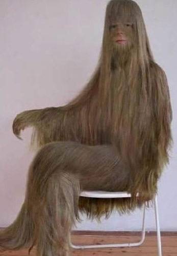 世界上體毛最長(zhǎng)的女人艾米麗·蘇珊,全身是毛如同猿猴