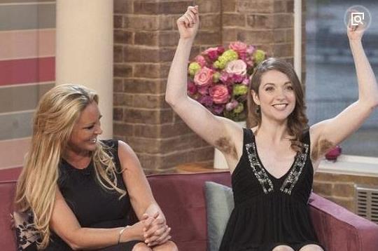 世界上體毛最長(zhǎng)的女人艾米麗·蘇珊,全身是毛如同猿猴