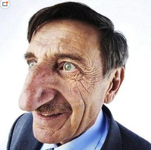 世界上鼻子最大最長的人.jpg