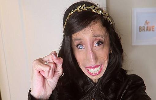 世界上最丑女人 利茲·維拉斯奎茲人雖丑卻很勵志