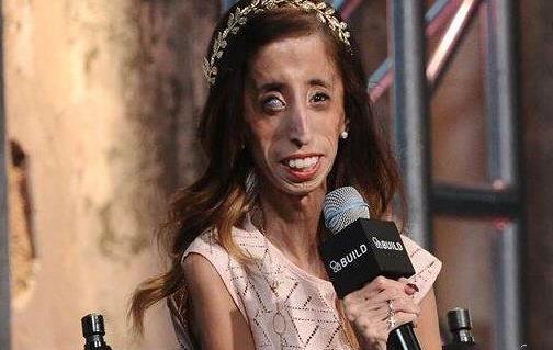 世界上最丑女人 利茲·維拉斯奎茲人雖丑卻很勵志