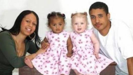 世界首對同母異父雙胞胎 2顆卵子同時著床 機率百萬分之一