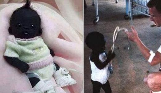 南非世界上最黑的孩子 證據證明90%是作假黑的不合常理