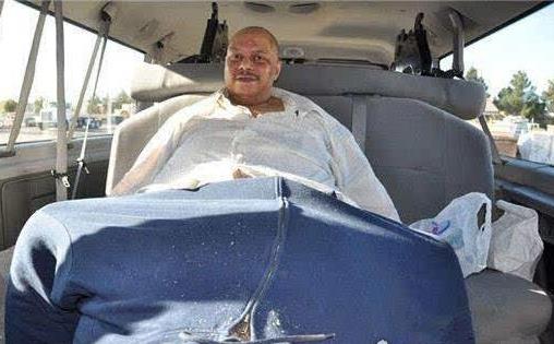 世界上最大的睪丸 最重一個60公斤目前紀錄是4.3公斤