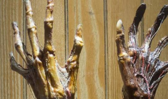 世界上最恐怖的博物館 存放畸形人遺體最多的馬特博物館