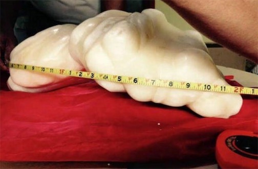 世界最大珍珠 菲律賓一漁民打撈出重34公斤的珍珠