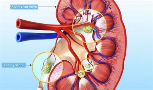 最早的人類腎移植 美國醫生休朱在1947年手術成功