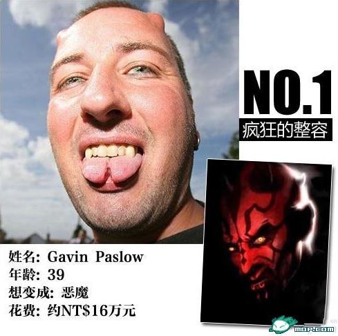 坑爹時代:那些奇葩的瘋狂變臉整容,坑爹呀