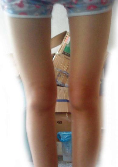 科普!有些大腿之間縫隙超大的女人完全是天生,與做那事OOXX無關(圖)