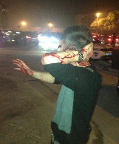 ��¶¶���d�ư��`Ҏ��Ѩ���ǁy�ӣ�����������¶¶��Ⱥ��(�D)