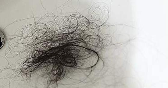 產后媽媽都會感覺到非常煩惱產后掉頭發 或許你可以這樣做