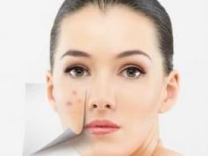 Ę���L������ʲôԭ��Ę���L������ô�{(di��o)�����ഺ����ô����