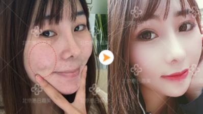 惠合嘉美整形好嗎 專業服務 塑造你的專屬美