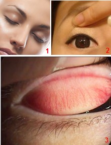 眼睛里進(jìn)東西怎么辦?眼睛進(jìn)異物怎么辦