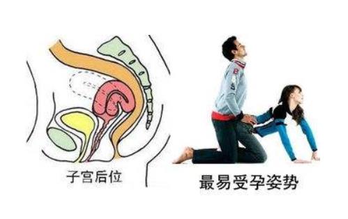 女性子宮后位影響受孕嗎 子宮后位懷孕的4個(gè)要點(diǎn)
