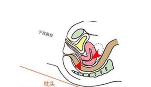 子宮前位容易懷孕嗎 子宮前位和子宮后位的區(qū)別