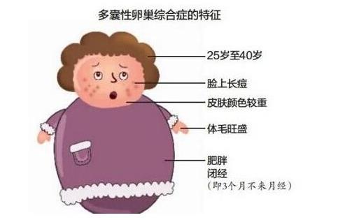 多囊卵巢如何受孕 多囊懷孕早期注意事項