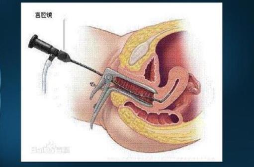 宮腔鏡檢查大概多少錢 宮腔鏡檢查多長時(shí)間