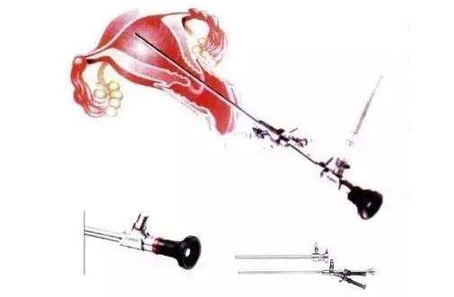 宮腔鏡檢查大概多少錢 宮腔鏡檢查多長時(shí)間