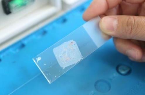 宮頸刮片結果怎么看 宮頸刮片的檢查項目