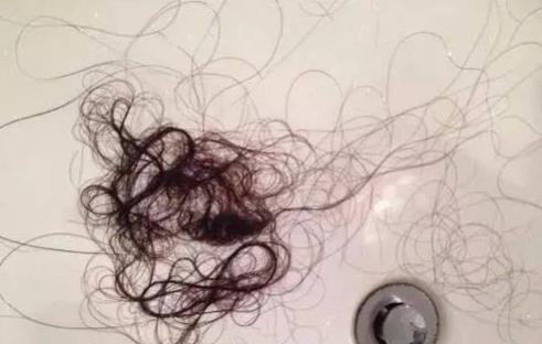 經(jīng)常掉頭發(fā)是什么原因造成的 怎么樣正確護(hù)理秀發(fā)