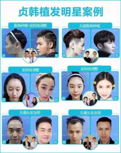 貞韓周年慶,鉅惠活動不停歇,現金好禮拿不停!你來我就送!