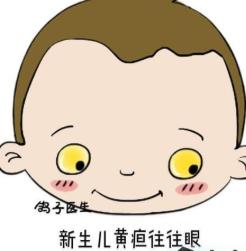 膽結石病人飲食要注意 4種食物是禁忌