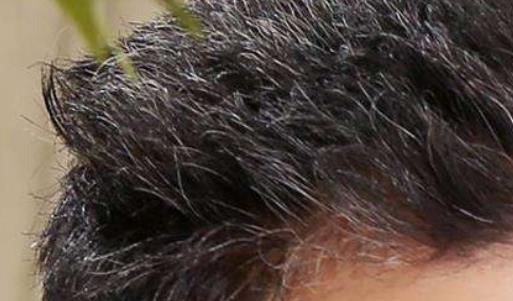 精神因素可能會導致少年白 推薦5種少年白發變黑吃的食物