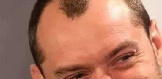 熬夜行為不可取男性要注意 推薦3種治療失眠的方法