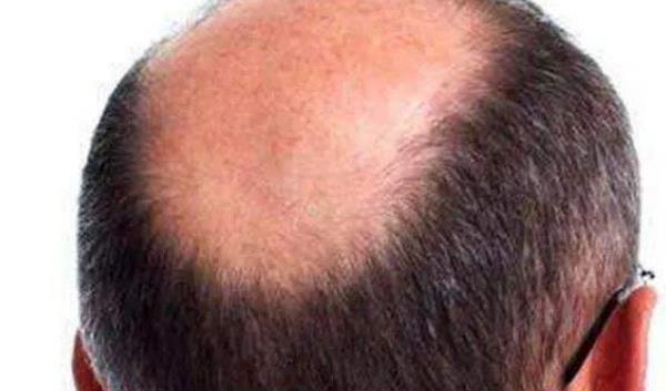 中年男人注意這四個問題 保健養生更不能少