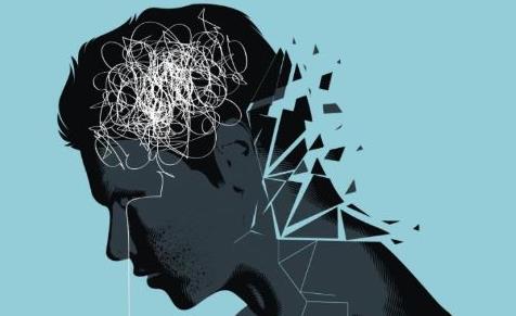 男性脫發的原因有哪些 職場壓力該怎么緩解