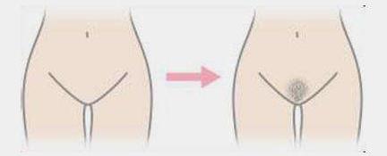 女性剃掉陰毛好嗎?女人私處體毛有何作用?女人私處陰毛多正常嗎