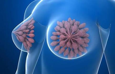 單純的乳腺增生好治嗎?乳腺增生的高發(fā)人群