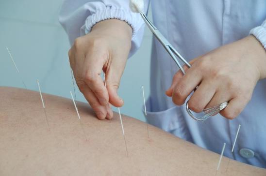 針灸豐胸有副作用嗎?針灸豐胸多久能見效?