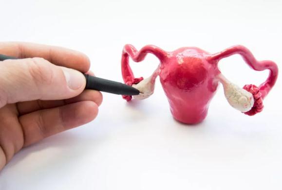 多囊卵巢綜合征是怎么回事?多囊卵巢綜合征對身體有哪些危害?