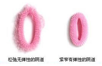 縮陰后的評價!縮陰什么產(chǎn)品效果最好