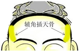 �����D�⣺�o�ǲ����