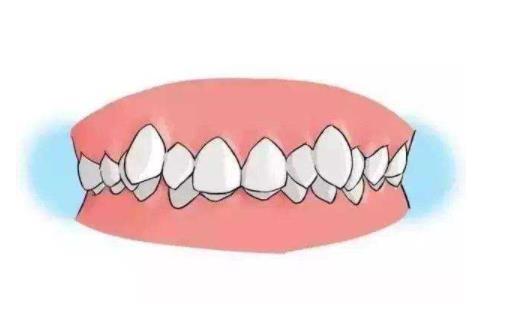 ��ͯ���X�C����������g ��ͯ���X�C���ķ�������Щ